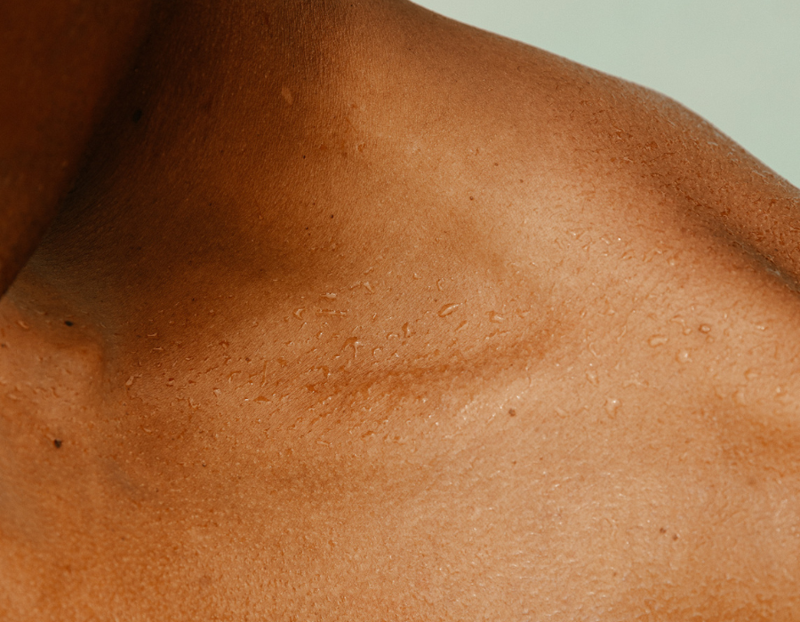 Les Erreurs Skincare Qui Aggravent l’Hyperpigmentation (et Comment les Éviter !)