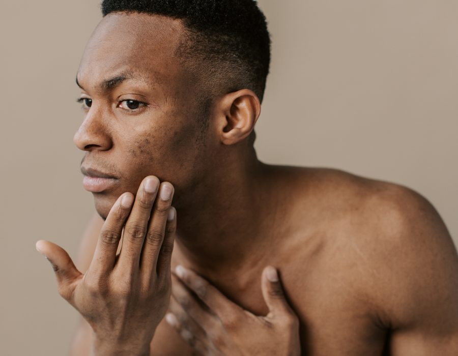 Qu’est-ce que l’Hyperpigmentation et Comment l’Éviter ?
